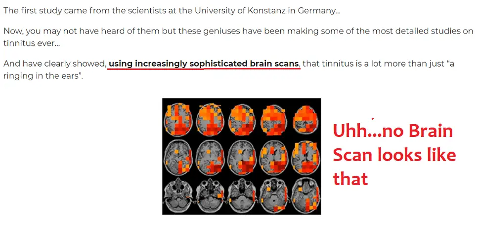 doctored brain scan sonus complete review